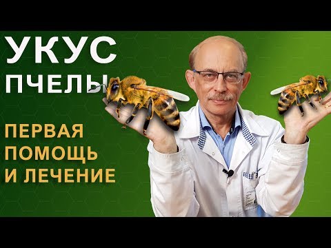 Укус пчелы - что делать, как снять опухоль, опасные симптомы, аллергия