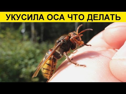 УКУС ОСЫ: ЧТО ДЕЛАТЬ? ПЕРВАЯ ПОМОЩЬ, ПОСЛЕДСТВИЯ ОТ УКУСА ОТ ОСЫ