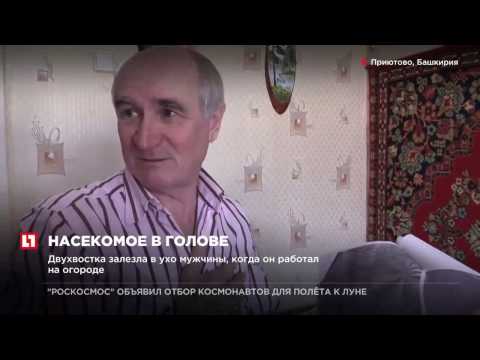 Башкирский пенсионер с сентября 2016 года живет с двухвостка в голове