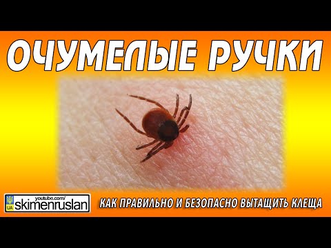 Как вытащить клеща ниткой / How to pull out a tick with a thread