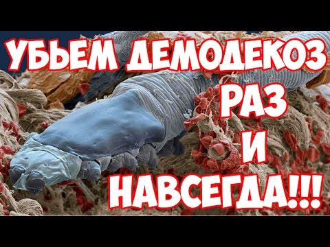 Демодекоз лечение. Как правильно лечить демодекоз на лице.