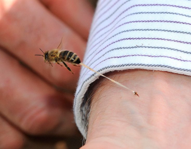Что делать если укусила пчела