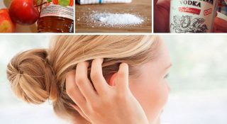 Народные средства от вшей и гнид